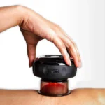 Revomadic Smart Cupping Massager – The Ultimate Cupping Therapy Device for Pain Relief & Muscle Recovery!